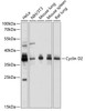 Western blot analysis of extracts of various cell lines, using Cyclin D2 antibody (18-075) at 1:1000 dilution.<br/>Secondary antibody: HRP Goat Anti-Rabbit IgG (H+L) at 1:10000 dilution.<br/>Lysates/proteins: 25ug per lane.<br/>Blocking buffer: 3% nonfat dry milk in TBST.<br/>Detection: ECL Basic Kit.<br/>Exposure time: 10s.