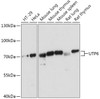 Western blot analysis of extracts of various cell lines, using UTP6 antibody (18-076) at 1:1000 dilution.<br/>Secondary antibody: HRP Goat Anti-Rabbit IgG (H+L) at 1:10000 dilution.<br/>Lysates/proteins: 25ug per lane.<br/>Blocking buffer: 3% nonfat dry milk in TBST.<br/>Detection: ECL Basic Kit.<br/>Exposure time: 5s.