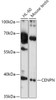 Western blot analysis of extracts of various cell lines, using CENPN antibody (18-077) at 1:1000 dilution.<br/>Secondary antibody: HRP Goat Anti-Rabbit IgG (H+L) at 1:10000 dilution.<br/>Lysates/proteins: 25ug per lane.<br/>Blocking buffer: 3% nonfat dry milk in TBST.<br/>Detection: ECL Basic Kit.<br/>Exposure time: 10s.