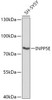 Western blot analysis of extracts of SH-SY5Y cells, using INPP5E antibody (18-080) at 1:1000 dilution.<br/>Secondary antibody: HRP Goat Anti-Rabbit IgG (H+L) at 1:10000 dilution.<br/>Lysates/proteins: 25ug per lane.<br/>Blocking buffer: 3% nonfat dry milk in TBST.<br/>Detection: ECL Basic Kit.<br/>Exposure time: 3s.