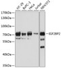 Western blot analysis of extracts of various cell lines, using IGF2BP2 antibody (18-082) at 1:1000 dilution.<br/>Secondary antibody: HRP Goat Anti-Rabbit IgG (H+L) at 1:10000 dilution.<br/>Lysates/proteins: 25ug per lane.<br/>Blocking buffer: 3% nonfat dry milk in TBST.<br/>Detection: ECL Basic Kit.<br/>Exposure time: 30s.