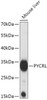 Western blot analysis of extracts of Mouse liver, using PYCRL antibody (18-092) at 1:1000 dilution.<br/>Secondary antibody: HRP Goat Anti-Rabbit IgG (H+L) at 1:10000 dilution.<br/>Lysates/proteins: 25ug per lane.<br/>Blocking buffer: 3% nonfat dry milk in TBST.<br/>Detection: ECL Basic Kit.<br/>Exposure time: 1s.