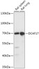 Western blot analysis of extracts of various cell lines, using DCAF17 antibody (18-096) at 1:1000 dilution.<br/>Secondary antibody: HRP Goat Anti-Rabbit IgG (H+L) at 1:10000 dilution.<br/>Lysates/proteins: 25ug per lane.<br/>Blocking buffer: 3% nonfat dry milk in TBST.<br/>Detection: ECL Basic Kit.<br/>Exposure time: 5s.