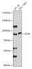 Western blot analysis of extracts of various cell lines, using SCIN antibody (18-106) at 1:1000 dilution.<br/>Secondary antibody: HRP Goat Anti-Rabbit IgG (H+L) at 1:10000 dilution.<br/>Lysates/proteins: 25ug per lane.<br/>Blocking buffer: 3% nonfat dry milk in TBST.<br/>Detection: ECL Basic Kit.<br/>Exposure time: 30s.