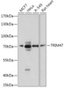 Western blot analysis of extracts of various cell lines, using TRIM47 antibody (18-108) at 1:1000 dilution.<br/>Secondary antibody: HRP Goat Anti-Rabbit IgG (H+L) at 1:10000 dilution.<br/>Lysates/proteins: 25ug per lane.<br/>Blocking buffer: 3% nonfat dry milk in TBST.<br/>Detection: ECL Basic Kit.<br/>Exposure time: 30s.