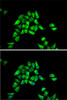 Immunofluorescence analysis of HeLa cells using DCTN1 antibody (18-125) . Blue: DAPI for nuclear staining.