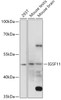 Western blot analysis of extracts of various cell lines, using IGSF11 antibody (18-128) at 1:1000 dilution.<br/>Secondary antibody: HRP Goat Anti-Rabbit IgG (H+L) at 1:10000 dilution.<br/>Lysates/proteins: 25ug per lane.<br/>Blocking buffer: 3% nonfat dry milk in TBST.<br/>Detection: ECL Basic Kit.<br/>Exposure time: 5s.