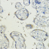 Immunohistochemistry of paraffin-embedded human placenta using BMPR1B antibody (18-138) at dilution of 1:200 (40x lens) .