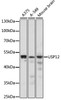 Western blot analysis of extracts of various cell lines, using USP12 antibody (18-141) at 1:1000 dilution.<br/>Secondary antibody: HRP Goat Anti-Rabbit IgG (H+L) at 1:10000 dilution.<br/>Lysates/proteins: 25ug per lane.<br/>Blocking buffer: 3% nonfat dry milk in TBST.<br/>Detection: ECL Enhanced Kit.<br/>Exposure time: 2min.