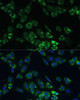 Immunofluorescence analysis of C6 cells using USP46 Polyclonal Antibody (18-142) at dilution of 1:100 (40x lens) . Blue: DAPI for nuclear staining.