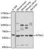 Western blot analysis of extracts of various cell lines, using NTNG1 antibody (18-147) at 1:1000 dilution.<br/>Secondary antibody: HRP Goat Anti-Rabbit IgG (H+L) at 1:10000 dilution.<br/>Lysates/proteins: 25ug per lane.<br/>Blocking buffer: 3% nonfat dry milk in TBST.<br/>Detection: ECL Basic Kit.<br/>Exposure time: 30s.