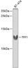 Western blot analysis of extracts of BT-474 cells, using TFF1 antibody (18-153) at 1:1000 dilution._Secondary antibody: HRP Goat Anti-Rabbit IgG (H+L) at 1:10000 dilution._Lysates/proteins: 25ug per lane._Blocking buffer: 3% nonfat dry milk in TBST._Detection: ECL Enhanced Kit._Exposure time: 90s.