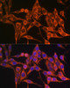 Immunofluorescence analysis of HeLa cells using MT-ATP8 antibody (18-154) at dilution of 1:100. Blue: DAPI for nuclear staining.
