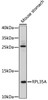 Western blot analysis of extracts of mouse stomach, using RPL35A antibody (18-164) at 1:500 dilution.<br/>Secondary antibody: HRP Goat Anti-Rabbit IgG (H+L) at 1:10000 dilution.<br/>Lysates/proteins: 25ug per lane.<br/>Blocking buffer: 3% nonfat dry milk in TBST.<br/>Detection: ECL Enhanced Kit.<br/>Exposure time: 3min.