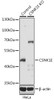 Western blot analysis of extracts from normal (control) and CSNK1E knockout (KO) HeLa cells, using CSNK1E antibody (18-170) at 1:1000 dilution.<br/>Secondary antibody: HRP Goat Anti-Rabbit IgG (H+L) at 1:10000 dilution.<br/>Lysates/proteins: 25ug per lane.<br/>Blocking buffer: 3% nonfat dry milk in TBST.<br/>Detection: ECL Basic Kit.<br/>Exposure time: 5s.