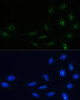 Immunofluorescence analysis of U-2 OS cells using NPM1 Polyclonal Antibody (18-178) at dilution of 1:100 (40x lens) . Blue: DAPI for nuclear staining.