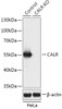 Western blot analysis of extracts from normal (control) and CALR knockout (KO) HeLa cells, using CALR antibody (18-200) at 1:3000 dilution.<br/>Secondary antibody: HRP Goat Anti-Rabbit IgG (H+L) at 1:10000 dilution.<br/>Lysates/proteins: 25ug per lane.<br/>Blocking buffer: 3% nonfat dry milk in TBST.<br/>Detection: ECL Basic Kit.<br/>Exposure time: 1s.