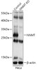 Western blot analysis of extracts from normal (control) and NNMT knockout (KO) HeLa cells, using NNMT antibody (18-221) at 1:1000 dilution.<br/>Secondary antibody: HRP Goat Anti-Rabbit IgG (H+L) at 1:10000 dilution.<br/>Lysates/proteins: 25ug per lane.<br/>Blocking buffer: 3% nonfat dry milk in TBST.<br/>Detection: ECL Basic Kit.<br/>Exposure time: 10s.