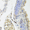 Immunohistochemistry of paraffin-embedded mouse lung using SDC2 antibody (18-291) at dilution of 1:100 (40x lens) .