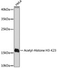 Western blot analysis of extracts of HeLa cells, using Acetyl-Histone H3-K23 antibody (18-310) at 1:1000 dilution.<br/>Secondary antibody: HRP Goat Anti-Rabbit IgG (H+L) at 1:10000 dilution.<br/>Lysates/proteins: 25ug per lane.<br/>Blocking buffer: 3% nonfat dry milk in TBST.<br/>Detection: ECL Basic Kit.<br/>Exposure time: 3min.