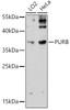 Western blot analysis of extracts of various cell lines, using PURB antibody (18-311) at 1:3000 dilution.<br/>Secondary antibody: HRP Goat Anti-Rabbit IgG (H+L) at 1:10000 dilution.<br/>Lysates/proteins: 25ug per lane.<br/>Blocking buffer: 3% nonfat dry milk in TBST.<br/>Detection: ECL Enhanced Kit.<br/>Exposure time: 90s.