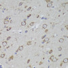 Immunohistochemistry of paraffin-embedded rat brain using PSAP antibody (18-320) at dilution of 1:200 (40x lens) .