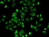 Immunofluorescence analysis of A-549 cells using HSD3B2 antibody (18-323) .