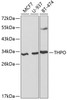 Western blot analysis of extracts of various cell lines, using THPO antibody (18-330) at 1:1000 dilution.<br/>Secondary antibody: HRP Goat Anti-Rabbit IgG (H+L) at 1:10000 dilution.<br/>Lysates/proteins: 25ug per lane.<br/>Blocking buffer: 3% nonfat dry milk in TBST.<br/>Detection: ECL Enhanced Kit.