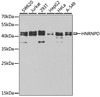 Western blot analysis of extracts of various cell lines, using HNRNPD antibody (18-333) at 1:1000 dilution.<br/>Secondary antibody: HRP Goat Anti-Rabbit IgG (H+L) at 1:10000 dilution.<br/>Lysates/proteins: 25ug per lane.<br/>Blocking buffer: 3% nonfat dry milk in TBST.<br/>Detection: ECL Basic Kit.<br/>Exposure time: 90s.