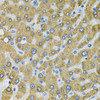 Immunohistochemistry of paraffin-embedded human liver damage using SDC4 Antibody (18-338) at dilution of 1:100 (40x lens) .