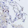 Immunohistochemistry of paraffin-embedded human lung using SFTPC antibody (18-339) at dilution of 1:200 (40x lens) .