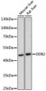 Western blot analysis of extracts of various cell lines, using DDB2 antibody (18-343) at 1:500 dilution.<br/>Secondary antibody: HRP Goat Anti-Rabbit IgG (H+L) at 1:10000 dilution.<br/>Lysates/proteins: 25ug per lane.<br/>Blocking buffer: 3% nonfat dry milk in TBST.<br/>Detection: ECL Basic Kit.<br/>Exposure time: 90s.