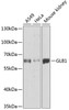 Western blot analysis of extracts of various cell lines, using GLB1 antibody (18-355) at 1:1000 dilution.<br/>Secondary antibody: HRP Goat Anti-Rabbit IgG (H+L) at 1:10000 dilution.<br/>Lysates/proteins: 25ug per lane.<br/>Blocking buffer: 3% nonfat dry milk in TBST.<br/>Detection: ECL Basic Kit.<br/>Exposure time: 30s.