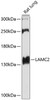 Western blot analysis of extracts of rat lung, using LAMC2 antibody (18-357) at 1:1000 dilution.<br/>Secondary antibody: HRP Goat Anti-Rabbit IgG (H+L) at 1:10000 dilution.<br/>Lysates/proteins: 25ug per lane.<br/>Blocking buffer: 3% nonfat dry milk in TBST.<br/>Detection: ECL Basic Kit.<br/>Exposure time: 60s.