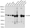Western blot analysis of extracts of various cell lines, using ACADM antibody (18-359) at 1:1000 dilution.<br/>Secondary antibody: HRP Goat Anti-Rabbit IgG (H+L) at 1:10000 dilution.<br/>Lysates/proteins: 25ug per lane.<br/>Blocking buffer: 3% nonfat dry milk in TBST.<br/>Detection: ECL Basic Kit.<br/>Exposure time: 1s.