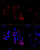Immunofluorescence analysis of HeLa cells using ABCG8 antibody (18-361) at dilution of 1:100 (40x lens) . Blue: DAPI for nuclear staining.
