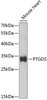 Western blot analysis of extracts of mouse heart, using PTGDS antibody (18-366) at 1:1000 dilution.<br/>Secondary antibody: HRP Goat Anti-Rabbit IgG (H+L) at 1:10000 dilution.<br/>Lysates/proteins: 25ug per lane.<br/>Blocking buffer: 3% nonfat dry milk in TBST.<br/>Detection: ECL Basic Kit.<br/>Exposure time: 90s.