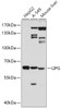 Western blot analysis of extracts of various cell lines, using LIPG antibody (18-368) at 1:500 dilution.<br/>Secondary antibody: HRP Goat Anti-Rabbit IgG (H+L) at 1:10000 dilution.<br/>Lysates/proteins: 25ug per lane.<br/>Blocking buffer: 3% nonfat dry milk in TBST.<br/>Detection: ECL Basic Kit.<br/>Exposure time: 90s.