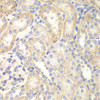 Immunohistochemistry of paraffin-embedded rat kidney using DLC1 antibody (18-386) at dilution of 1:200 (40x lens) .