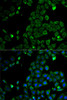 Immunofluorescence analysis of HeLa cells using MSR1 antibody (18-388) . Blue: DAPI for nuclear staining.