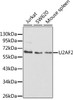 Western blot analysis of extracts of various cell lines, using U2AF2 antibody (18-399) at 1:1000 dilution.<br/>Secondary antibody: HRP Goat Anti-Rabbit IgG (H+L) at 1:10000 dilution.<br/>Lysates/proteins: 25ug per lane.<br/>Blocking buffer: 3% nonfat dry milk in TBST.