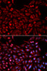 Immunofluorescence analysis of U2OS cells using NR1I3 antibody (18-419) . Blue: DAPI for nuclear staining.