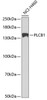 Western blot analysis of extracts of NCI-H460 cells, using PLCB1 antibody (18-420) at 1:1000 dilution.<br/>Secondary antibody: HRP Goat Anti-Rabbit IgG (H+L) at 1:10000 dilution.<br/>Lysates/proteins: 25ug per lane.<br/>Blocking buffer: 3% nonfat dry milk in TBST.