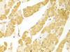 Immunohistochemistry of paraffin-embedded rat heart using PLCB1 antibody (18-420) at dilution of 1:100 (40x lens) .