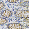 Immunohistochemistry of paraffin-embedded human colon using PTPRA Antibody (18-424) at dilution of 1:100 (40x lens) .
