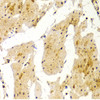 Immunohistochemistry of paraffin-embedded human esophagus using MVP Antibody (18-427) at dilution of 1:100 (40x lens) .