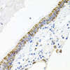 Immunohistochemistry of paraffin-embedded human lung using ACVR2A antibody (18-428) at dilution of 1:100 (40x lens) .