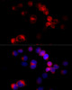 Immunofluorescence analysis of HeLa cells using CYP27A1 antibody (18-429) at dilution of 1:100 (40x lens) . Blue: DAPI for nuclear staining.