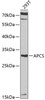 Western blot analysis of extracts of 293T cells, using APCS antibody (18-435) at 1:1000 dilution.<br/>Secondary antibody: HRP Goat Anti-Rabbit IgG (H+L) at 1:10000 dilution.<br/>Lysates/proteins: 25ug per lane.<br/>Blocking buffer: 3% nonfat dry milk in TBST.<br/>Detection: ECL Enhanced Kit.<br/>Exposure time: 50s.
