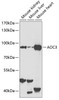 Western blot analysis of extracts of various cell lines, using AOC3 antibody (18-438) at 1:1000 dilution.<br/>Secondary antibody: HRP Goat Anti-Rabbit IgG (H+L) at 1:10000 dilution.<br/>Lysates/proteins: 25ug per lane.<br/>Blocking buffer: 3% nonfat dry milk in TBST.<br/>Detection: ECL Enhanced Kit.<br/>Exposure time: 60s.